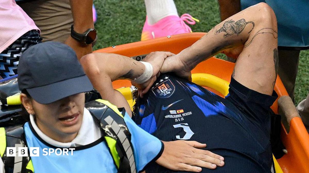 Ugarte sofre lesão grave e Manchester United enfrenta desafio